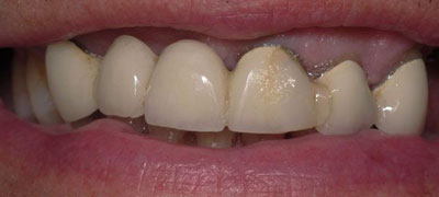 Close-up view of teeths