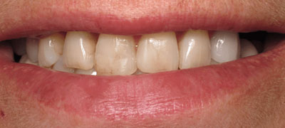 close-up view of person teeth