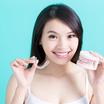 What Invisalign Aligners Are and Why They Are Popular