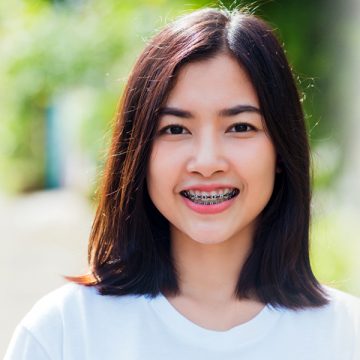 Orthodontics Is What You Need to Correct Imperfections with Your Teeth