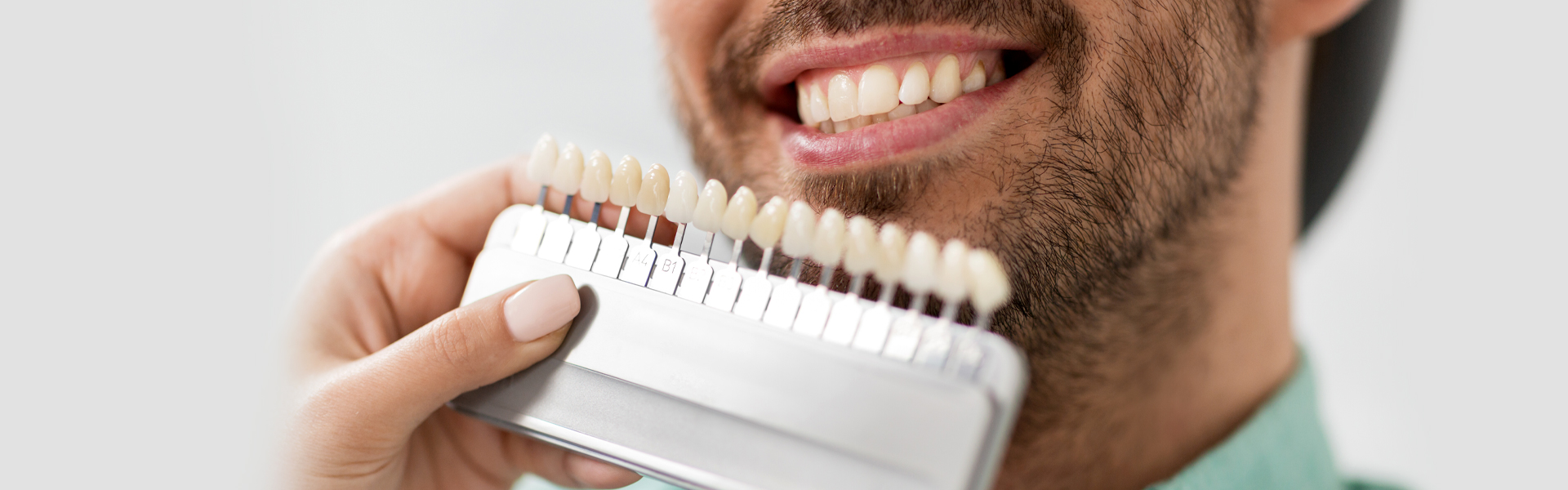 Person comparing teeth color with a dental shade guide