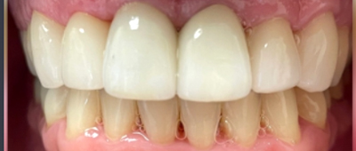 Close-up view of healthy human teeth and gums