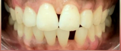 Close-up view of healthy white teeth