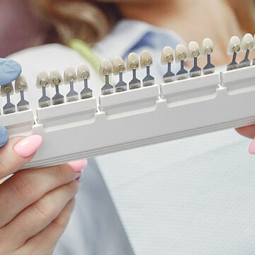 Do Porcelain Veneers Look Natural? What You Need to Know